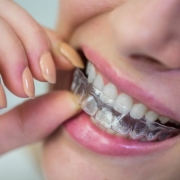 A person placing a clear dental aligner over their teeth, showing a close-up of their mouth and hand.